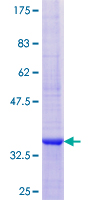 12.5% SDS-PAGE Stained with Coomassie Blue.